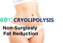 unlock-your-dream-body:-the-revolutionarypower-of-360-cryolipolysis-weight-lossmachine